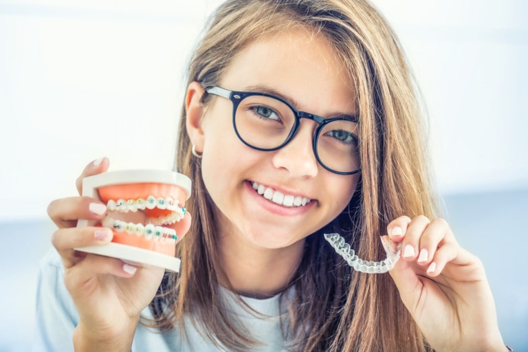 Zahnspange, Brackets und ihre Alternativen